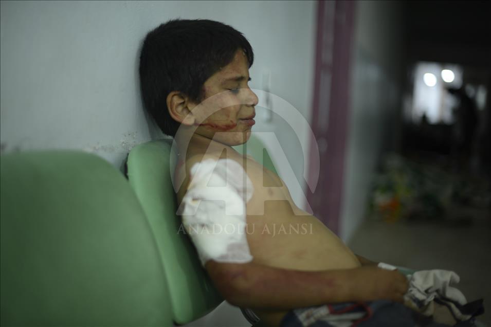 Terör örgütü PKK/PYD'den Mare'ye saldırı: 3 ölü 6 yaralı
