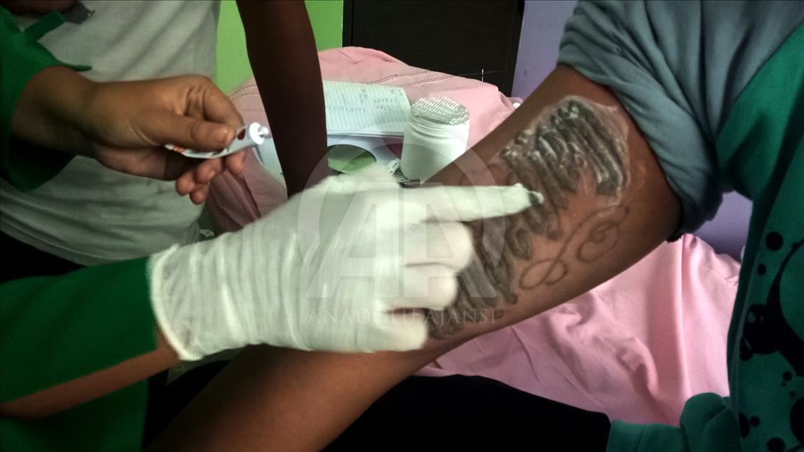 Penghapusan Tattoo Program 'Berani Hijrah Itu Baik'