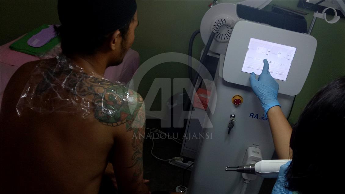 Penghapusan Tattoo Program 'Berani Hijrah Itu Baik'