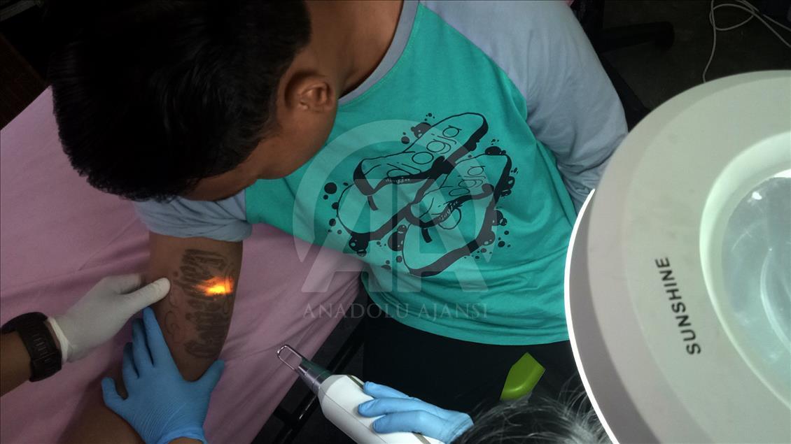 Penghapusan Tattoo Program 'Berani Hijrah Itu Baik'