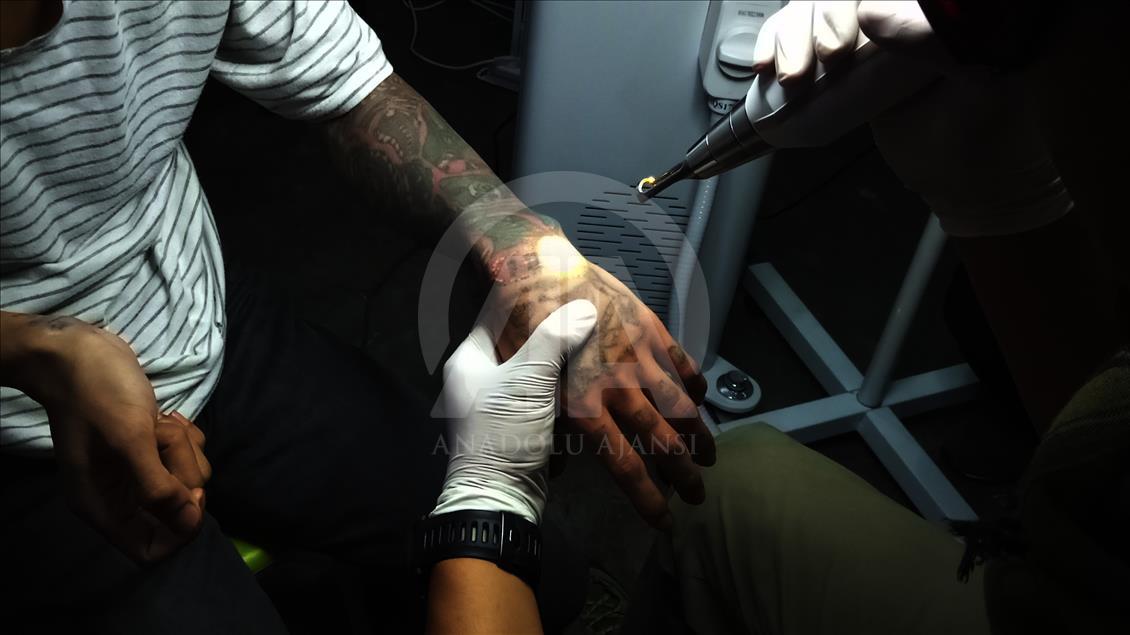 Penghapusan Tattoo Program 'Berani Hijrah Itu Baik'