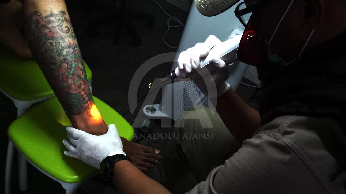 Penghapusan Tattoo Program 'Berani Hijrah Itu Baik'
