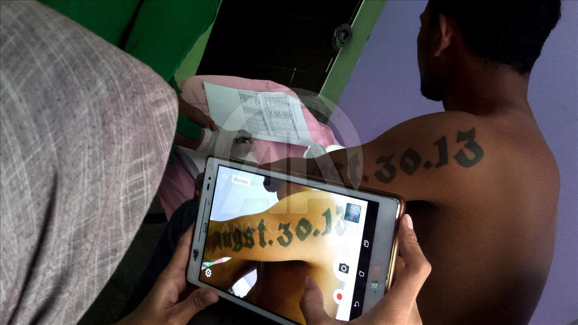 Penghapusan Tattoo Program 'Berani Hijrah Itu Baik'