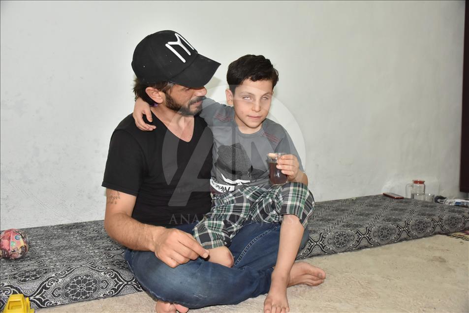 Amputé d’une jambe dans l’explosion d’une bombe de Daech, un enfant syrien veut avoir une prothèse 
