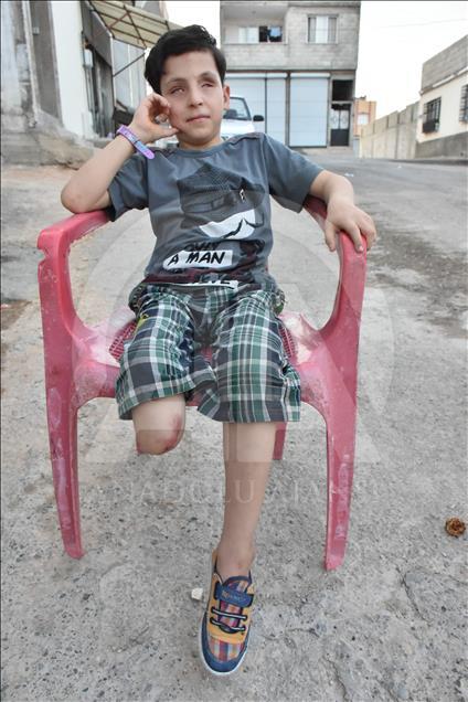 Amputé d’une jambe dans l’explosion d’une bombe de Daech, un enfant syrien veut avoir une prothèse 
