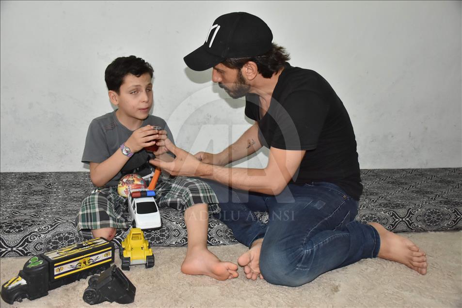 Amputé d’une jambe dans l’explosion d’une bombe de Daech, un enfant syrien veut avoir une prothèse 
