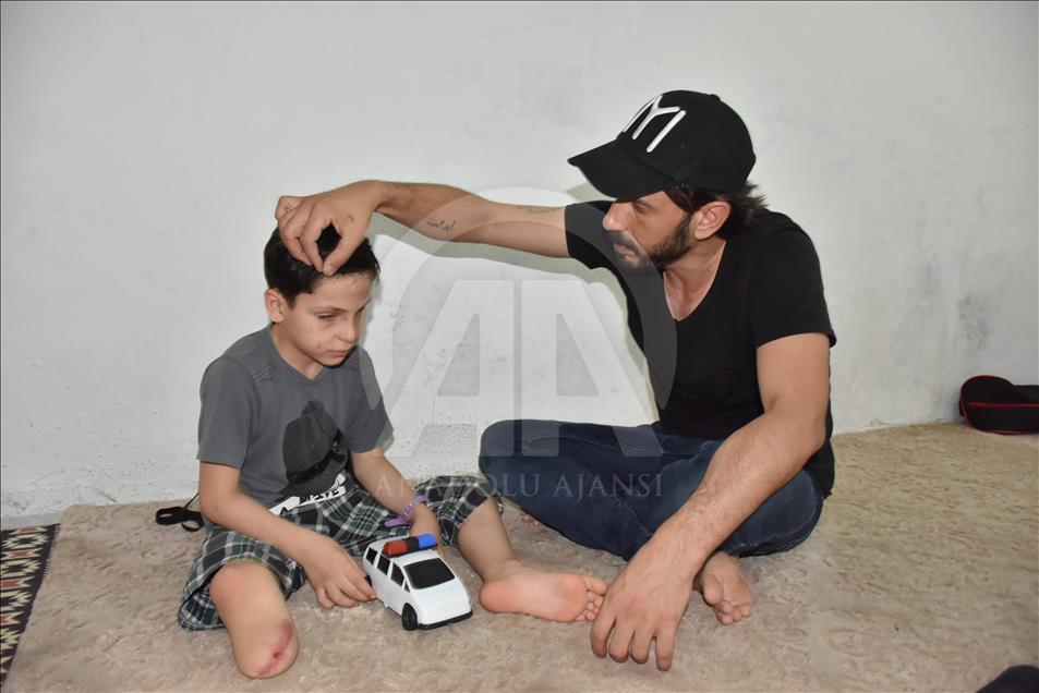 Amputé d’une jambe dans l’explosion d’une bombe de Daech, un enfant syrien veut avoir une prothèse 
