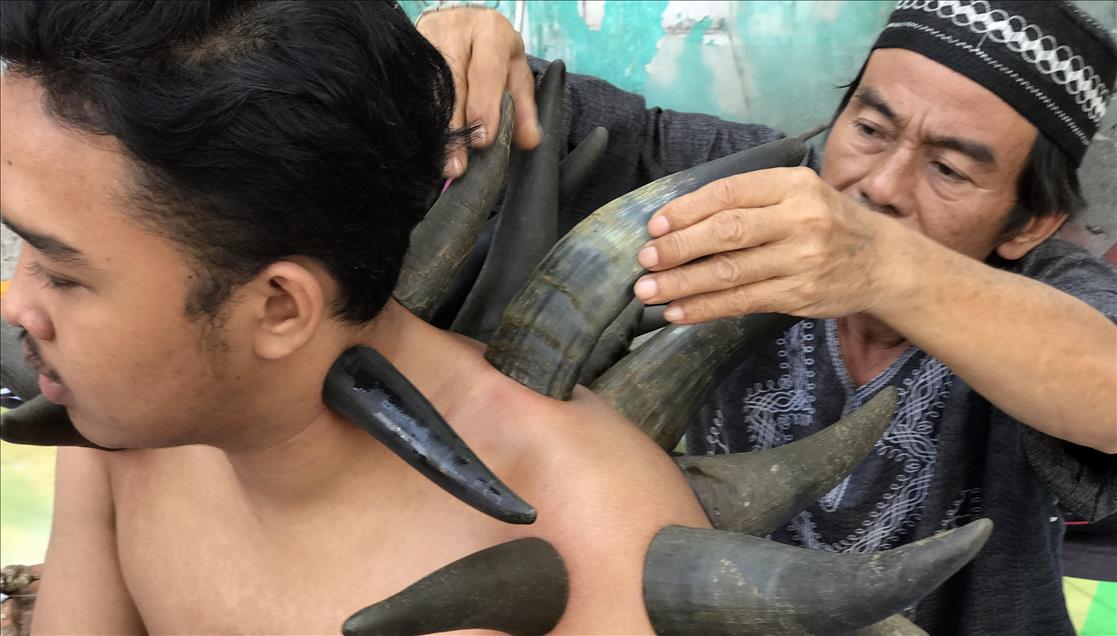 Cupping therapy with buffalo horns
