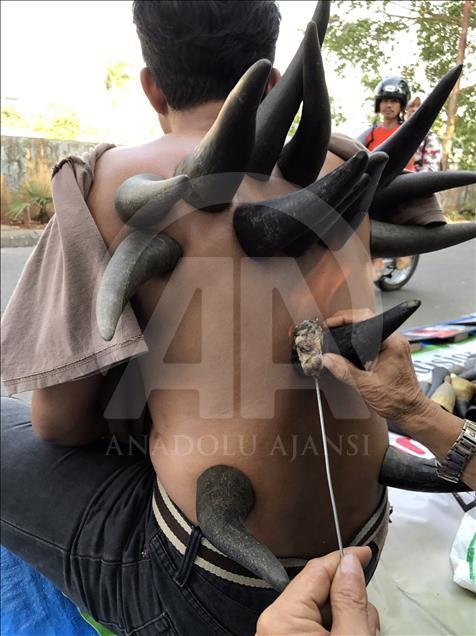 Cupping therapy with buffalo horns
