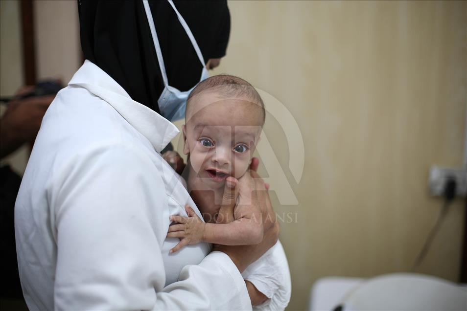 Malnutrition kills 2 babies in Syria’s Eastern Ghouta