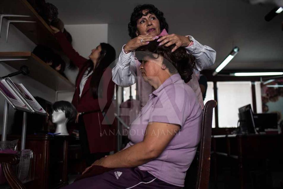 Perder el cabello puede cambiarte la vida