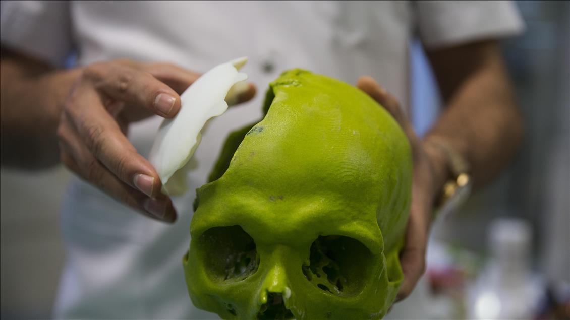 Kanser cerrahisinde "3D" teknolojisi