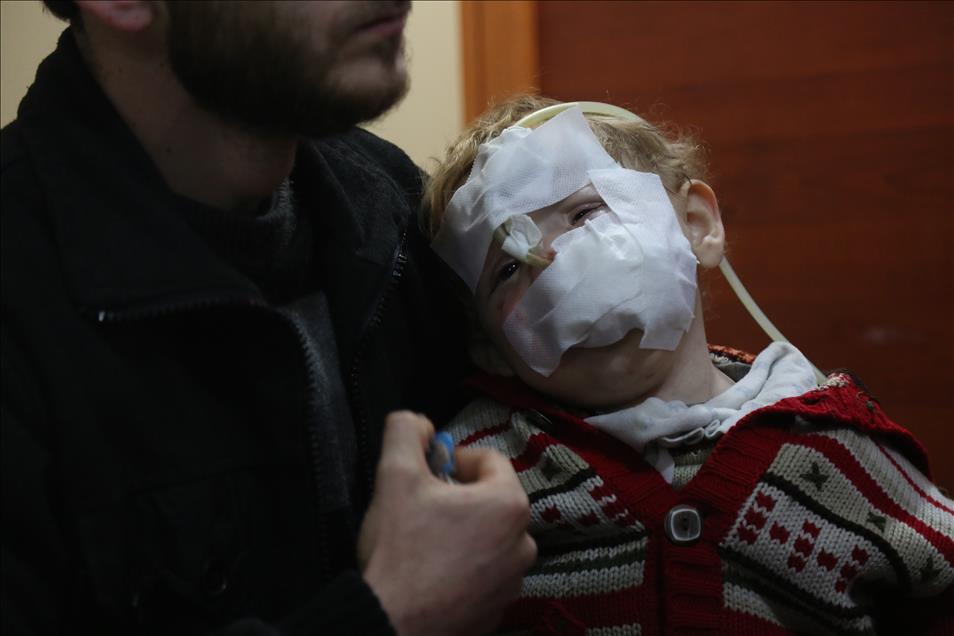Two-year-old Syrian baby Qasim waits for treatment