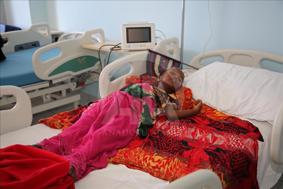 بیمارستان ترکیه شفابخش مردم سومالی شده است