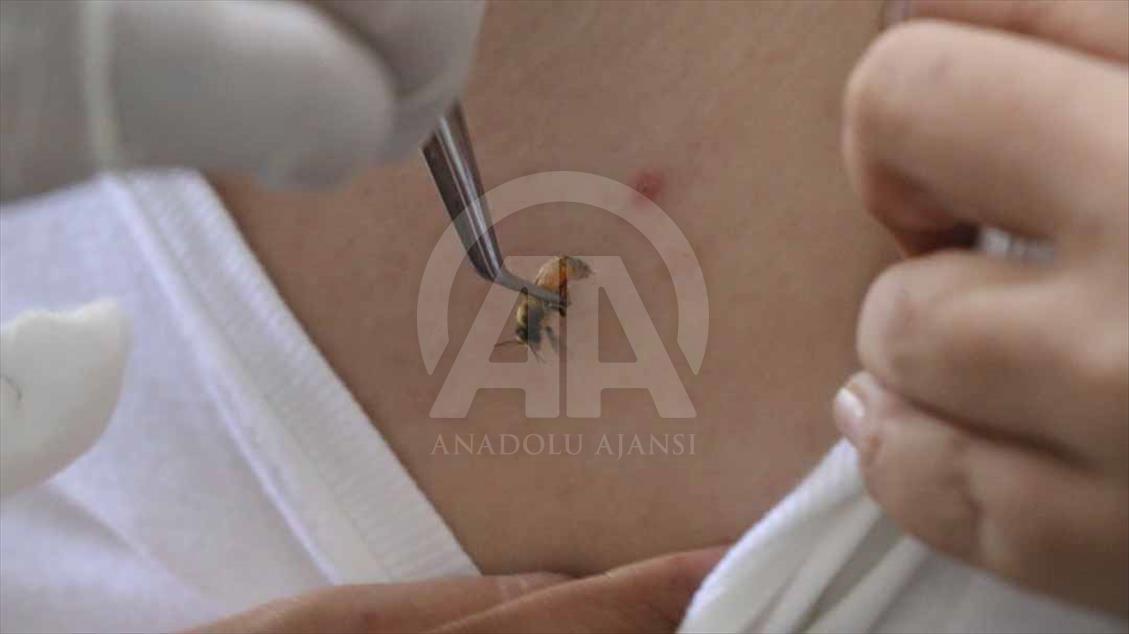 Indonesios fortalecen su sistema inmune con picaduras de abejas