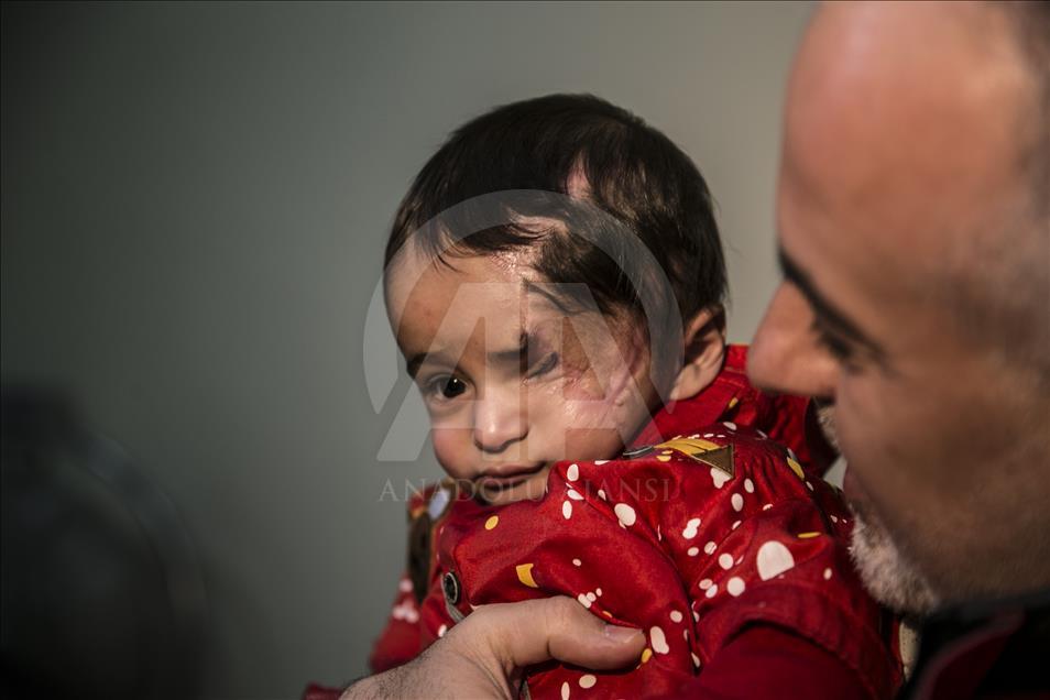 U Tursku evakuirana beba Karim, simbol otpora i stradanja civila Istočne Gute