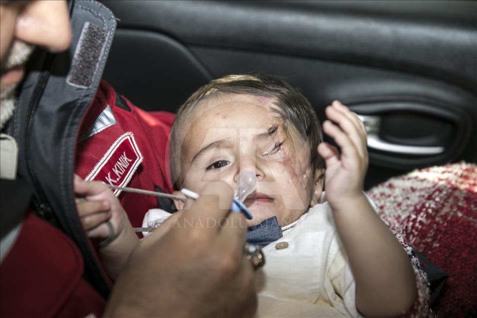 U Tursku evakuirana beba Karim, simbol otpora i stradanja civila Istočne Gute