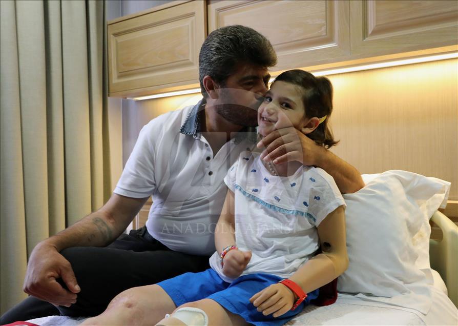 أطباء أتراك يعيدون الأمل لطفلة سورية مزقت الحرب جسدها