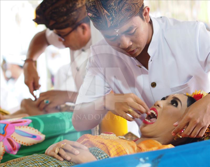 Metatah tradisi potong gigi umat Hindu di Bali