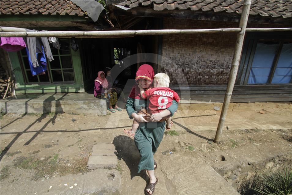 Ciburuy, a village with the highest number of albinos in Indonesia