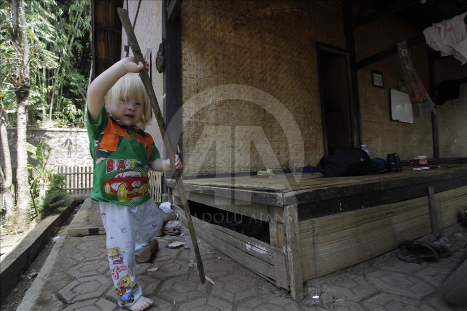 Ciburuy kampung dengan jumlah albino terbanyak di Indonesia