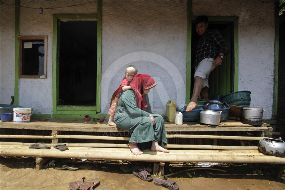 Ciburuy kampung dengan jumlah albino terbanyak di Indonesia