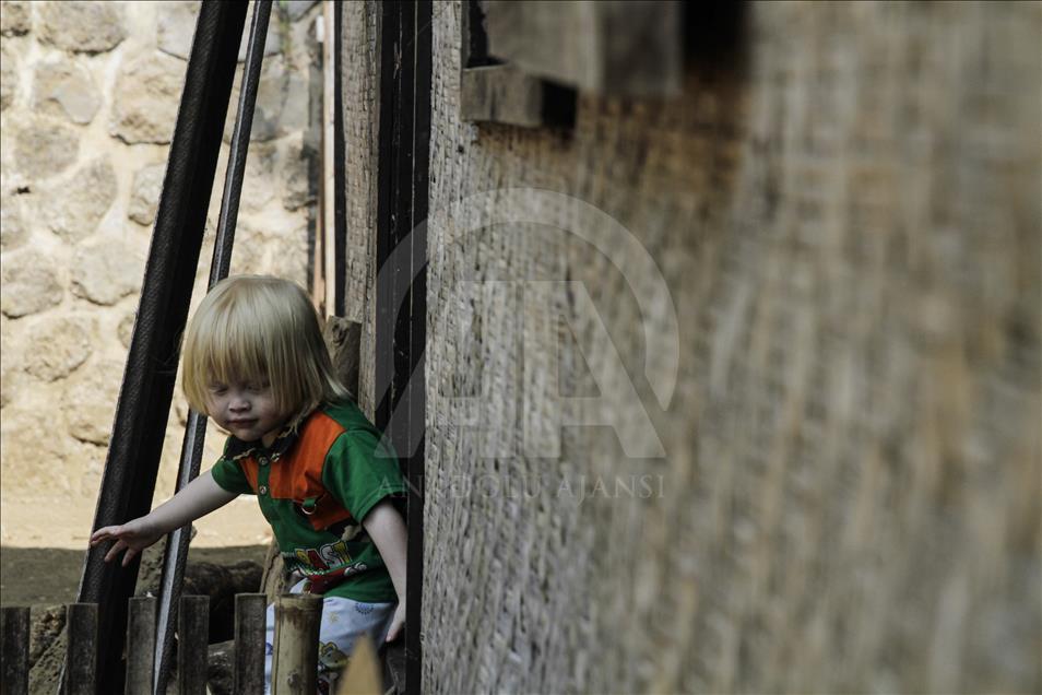 Ciburuy, un pueblo con el mayor número de albinos en Indonesia