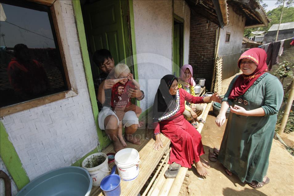 Ciburuy kampung dengan jumlah albino terbanyak di Indonesia