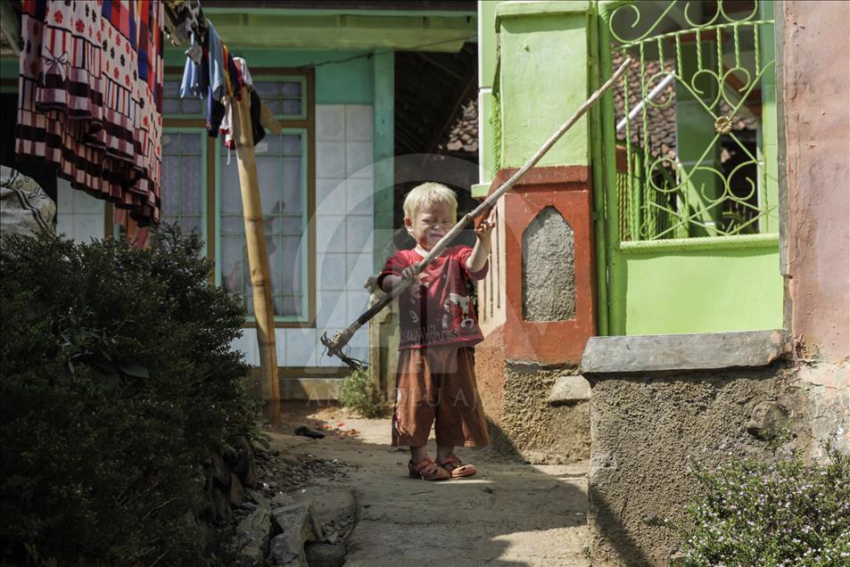 Ciburuy, un pueblo con el mayor número de albinos en Indonesia