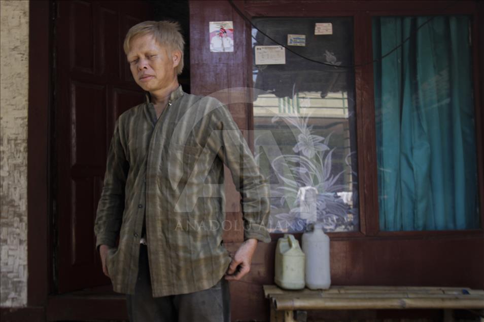 Ciburuy, un pueblo con el mayor número de albinos en Indonesia