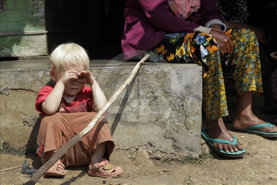 Ciburuy, un pueblo con el mayor número de albinos en Indonesia