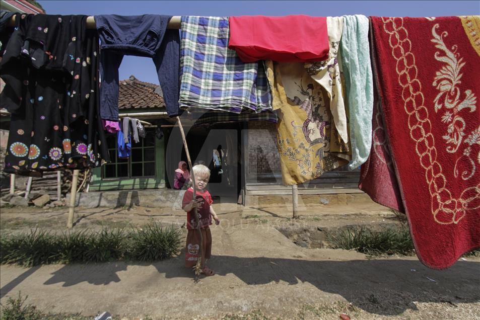 Ciburuy, un pueblo con el mayor número de albinos en Indonesia