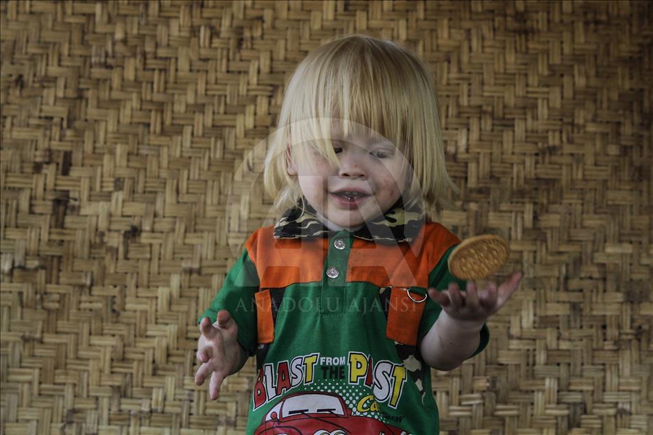 Ciburuy, un pueblo con el mayor número de albinos en Indonesia