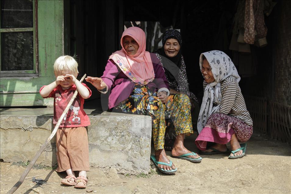 Ciburuy kampung dengan jumlah albino terbanyak di Indonesia