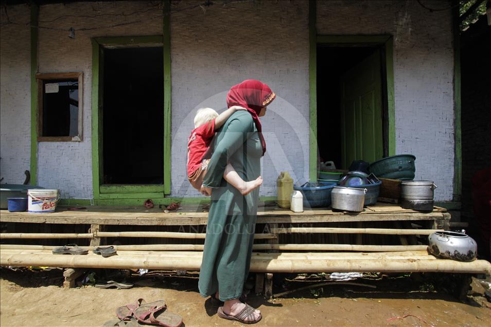 Ciburuy, un pueblo con el mayor número de albinos en Indonesia