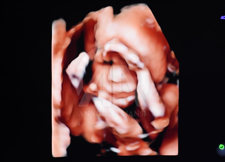 Ultrason fotoğraflarından koleksiyon yaptı