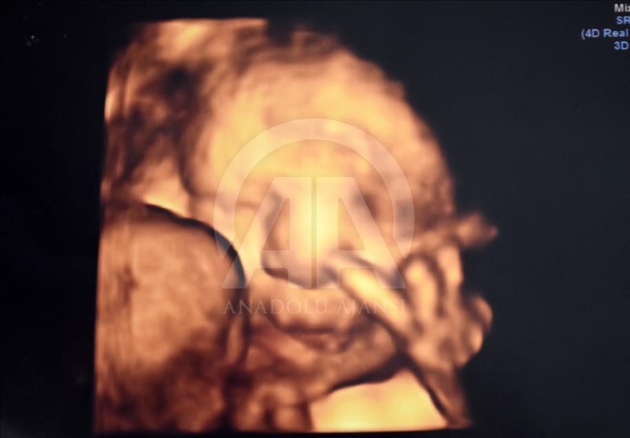 Ultrason fotoğraflarından koleksiyon yaptı