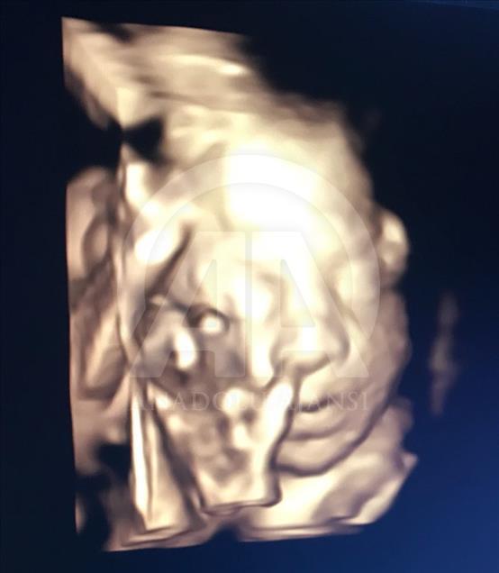 Ultrason fotoğraflarından koleksiyon yaptı