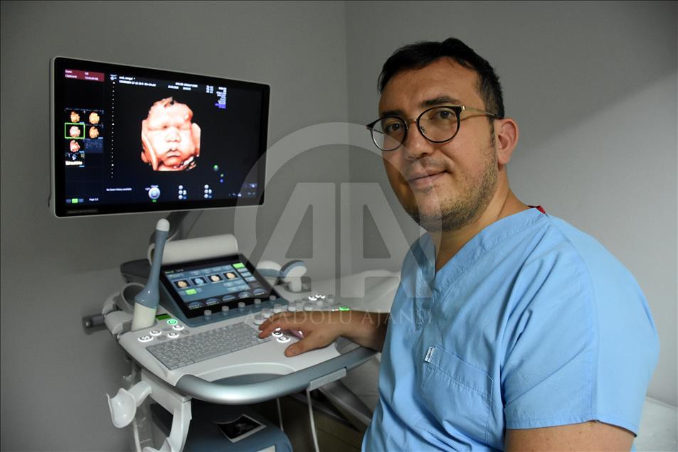 Ultrason fotoğraflarından koleksiyon yaptı