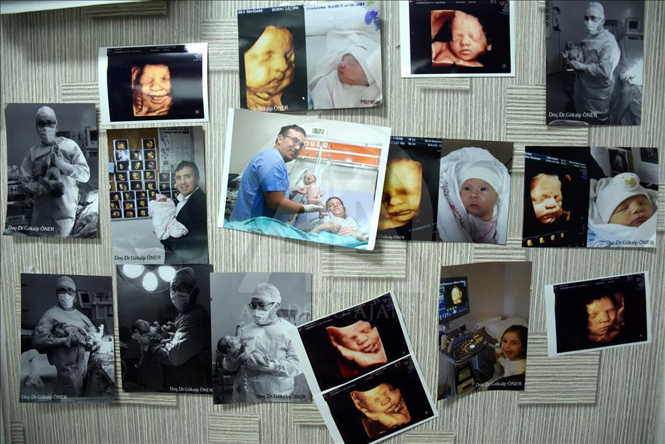 Ultrason fotoğraflarından koleksiyon yaptı