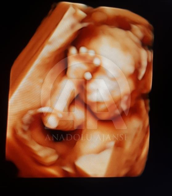 Ultrason fotoğraflarından koleksiyon yaptı