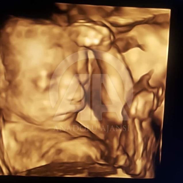 Ultrason fotoğraflarından koleksiyon yaptı