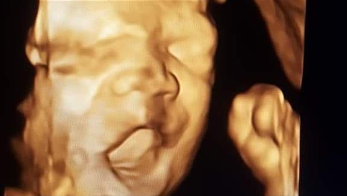 Ultrason fotoğraflarından koleksiyon yaptı