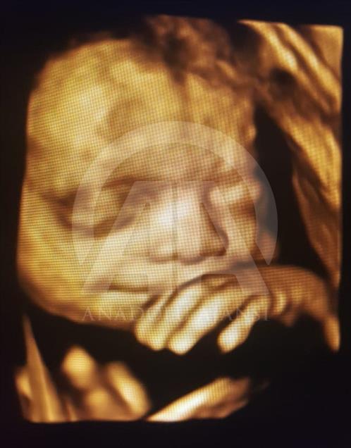 Ultrason fotoğraflarından koleksiyon yaptı