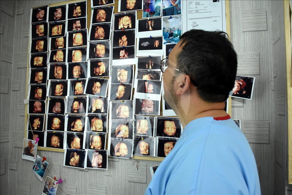 Ultrason fotoğraflarından koleksiyon yaptı