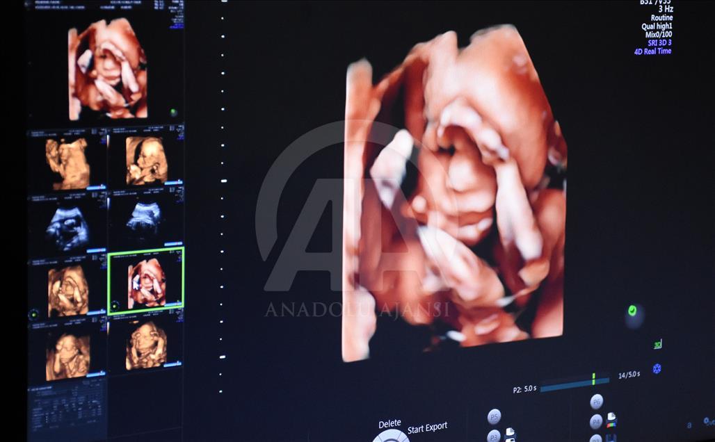 Ultrason fotoğraflarından koleksiyon yaptı