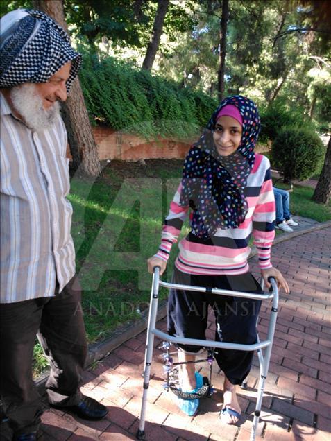 بعد 22 عملية جراحية.. شابة سورية تمشي مجددًا في تركيا 
