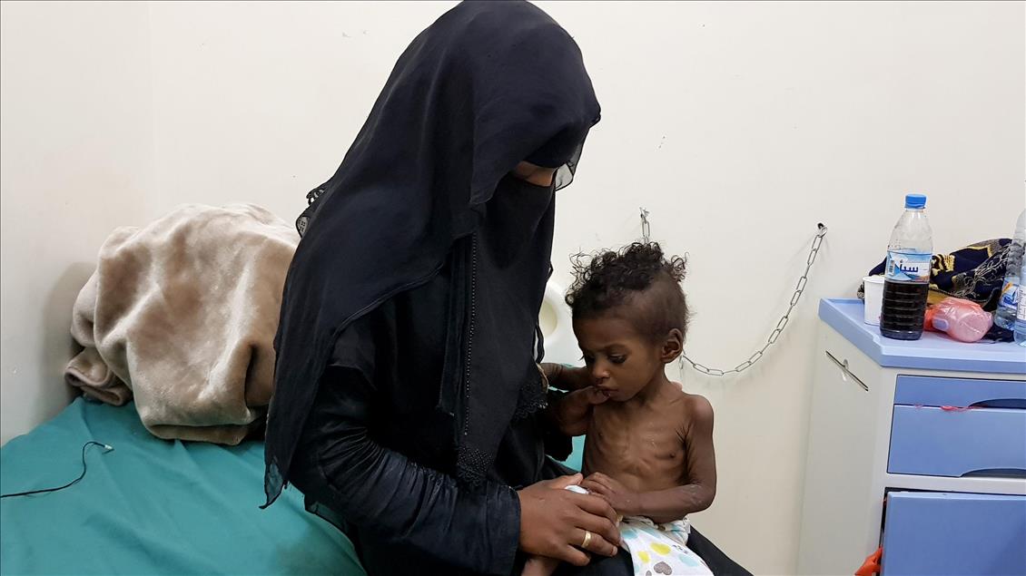 Yemen'de kıtlık en çok çocukları vuruyor