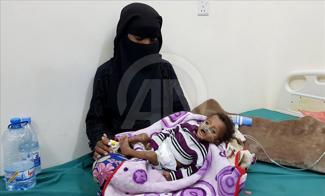 Yemen'de kıtlık en çok çocukları vuruyor