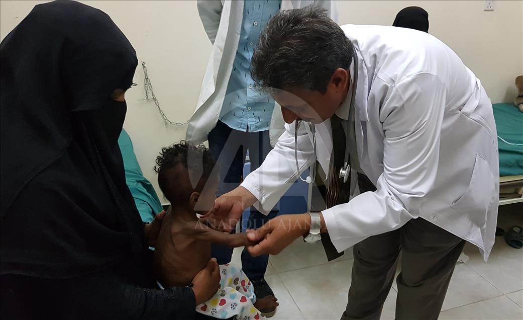 Yemen'de kıtlık en çok çocukları vuruyor